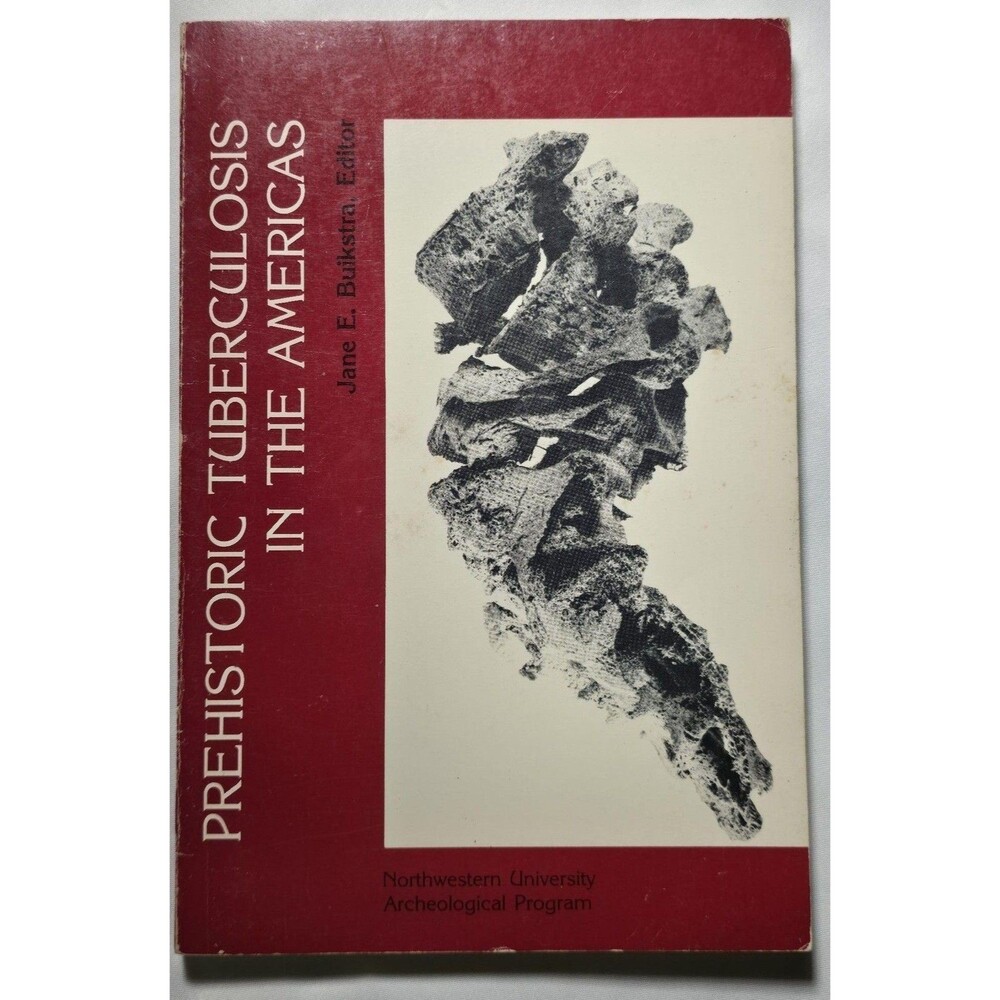 1981 Prehistoric Tuberculosis In The Americas Jane E. Buikstra PB Native Disease